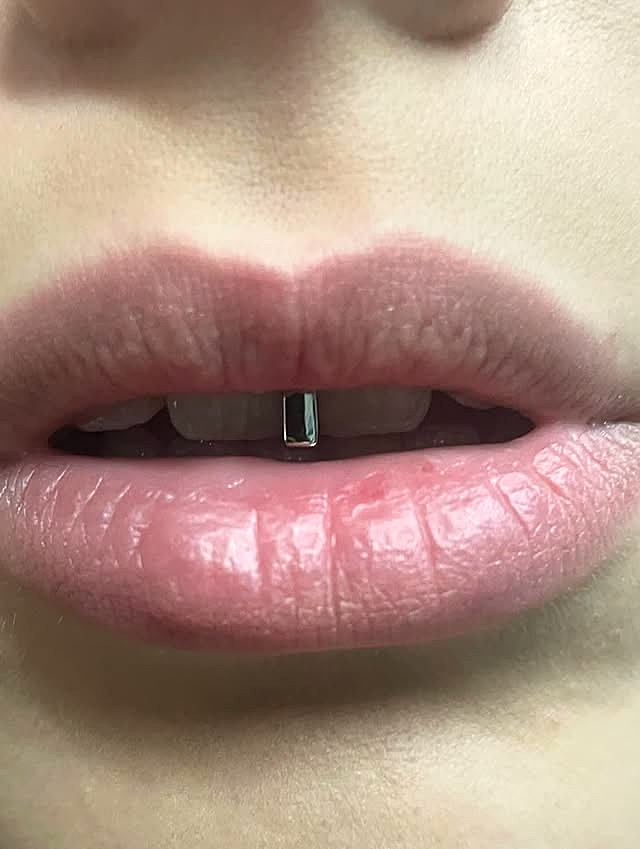 แคปบาร์เงินซี่เดียวสไตล์มินิมอล ใส่จริงโดยลูกค้าในกรุงเทพฯ